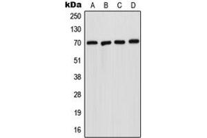 Western blot analysis of Acid Sphingomyelinase expression in A431 (A), HepG2 (B), SP2/0 (C), H9C2 (D) whole cell lysates. (SMPD1 antibody  (Center))