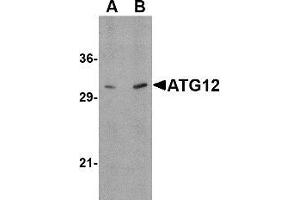 Western blot: ATG12 antibody staining of Human brain tissue lysate at (A) 0.