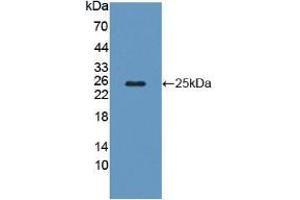Figure. (Calcyphosine antibody  (AA 1-189))