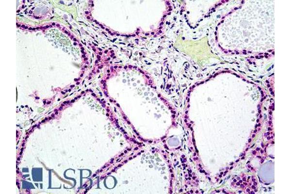 PTPN22 antibody  (Internal Region)