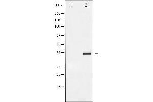 Western blot analysis of I kappaB- beta phosphorylation expression in TNF-a treated HeLa whole cell lysates,The lane on the left is treated with the antigen-specific peptide. (NFKBIB antibody  (pSer23))