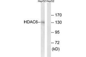 Western blot analysis of extracts from HepG2 cells, using HDAC6 (Ab-22) Antibody. (HDAC6 antibody  (AA 7-56))