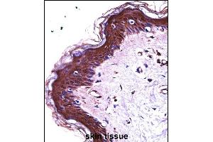 S100A7 Antibody (N-term) ((ABIN657716 and ABIN2846704))immunohistochemistry analysis in formalin fixed and paraffin embedded human skin tissue followed by peroxidase conjugation of the secondary antibody and DAB staining. (S100A7 antibody  (N-Term))