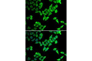 Immunofluorescence analysis of U20S cell using TRIP10 antibody. (TRIP10 antibody)