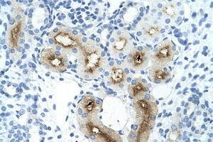 Image no. 1 for anti-gamma-Glutamyltransferase Light Chain 1 (GGTLC1) (C-Term) antibody (ABIN204972) (GGTLC1 antibody  (C-Term))