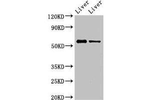 Western Blot Positive WB detected in: Mouse liver tissue, Rat liver tissue All lanes: ETV1 antibody at 3 μg/mL Secondary Goat polyclonal to rabbit IgG at 1/50000 dilution Predicted band size: 56, 54, 53, 44, 49, 51 kDa Observed band size: 56 kDa (ETV1 antibody  (AA 61-332))