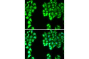 Immunofluorescence analysis of U20S cell using MALT1 antibody. (MALT1 antibody  (AA 125-450))