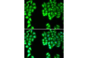 Immunofluorescence analysis of U20S cell using MALT1 antibody. (MALT1 antibody  (AA 125-450))