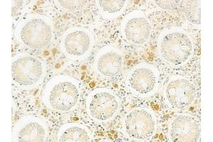 ABIN6260943 and ABIN6266830 at 1/100 staining human normal colon tissue by IHC-P. (Collagen IV antibody)