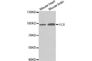 Western blot analysis of extracts of various cell lines, using FES antibody. (FES antibody  (AA 120-420))