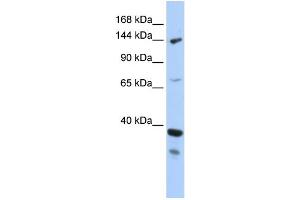 WB Suggested Anti-DHX37 Antibody Titration:  0.