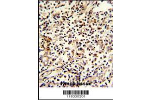 Formalin-fixed and paraffin-embedded human lymph reacted with PCM-1 Antibody , which was peroxidase-conjugated to the secondary antibody, followed by DAB staining. (PCM1 antibody  (C-Term))