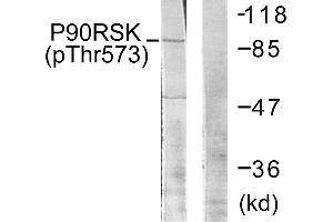 Western blot analysis of extracts from 293 cells, treated with UV (30 mins), using p90 RSK (Phospho-Thr573) antibody. (RPS6KA3 antibody  (pThr573))