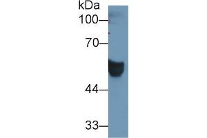 Western blot analysis of Human Serum, using Human CEACAM1 Antibody (1 µg/ml) and HRP-conjugated Goat Anti-Rabbit antibody (