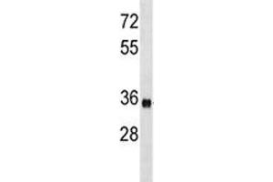 ISL1 antibody western blot analysis in mouse bladder tissue lysate. (ISL1 antibody  (AA 156-185))