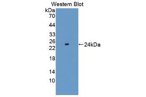 Figure. (CRYGS antibody  (AA 2-178))