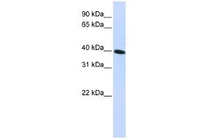 WB Suggested Anti-CARKD Antibody Titration:  0. (Carkd antibody  (Middle Region))