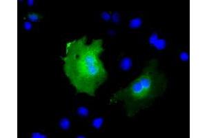 Anti-KBTBD7 mouse monoclonal antibody (ABIN2453189) immunofluorescent staining of COS7 cells transiently transfected by pCMV6-ENTRY KBTBD7 (RC205559). (KBTBD7 antibody)