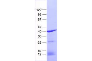 Validation with Western Blot
