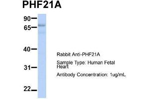 Host:  Rabbit  Target Name:  PHF21A  Sample Type:  Human Fetal Heart  Antibody Dilution:  1.