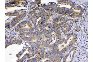 IHC analysis of SCF using anti-SCF antibody . (KIT Ligand antibody  (AA 26-190))