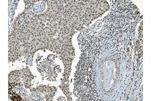 IHC analysis of TAF4 using anti-TAF4 antibody (ABIN7602114).