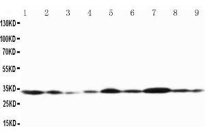 Western Blotting (WB) image for anti-Gap Junction Protein, beta 1, 32kDa (GJB1) (AA 215-231), (Middle Region) antibody (ABIN3042611) (GJB1 antibody  (Middle Region))