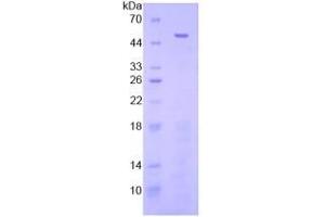 SDS-PAGE analysis of Human FGL2 Protein.