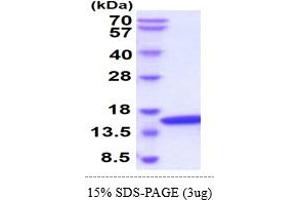 SDS-PAGE (SDS) image for Ubiquitin-Conjugating Enzyme E2D 2 (UBE2D2) (AA 1-147) protein (ABIN5855026)
