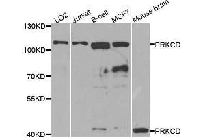 Western blot analysis of extracts of various cell lines, using PRKCD antibody. (PKC delta antibody)