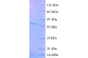 SDS-PAGE (SDS) image for Calcium Activated Nucleotidase 1 (CANT1) (AA 80-397), (partial) protein (His tag) (ABIN4976340)