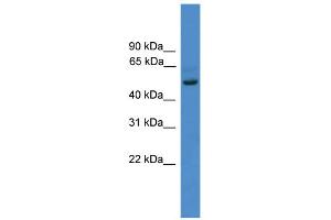 WB Suggested Anti-ZNF277 Antibody Titration:  0. (ZNF277 antibody  (N-Term))
