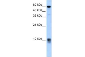 Western Blotting (WB) image for anti-S100 Calcium Binding Protein A3 (S100A3) antibody (ABIN2462524) (S100A3 antibody)