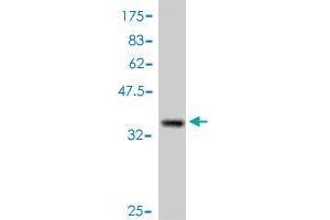 Western Blot detection against Immunogen (35. (CTNNBIP1 antibody  (AA 1-81))