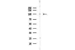 anti-N-Acetyltransferase 10 (GCN5-Related) (NAT10) (Internal Region) antibody
