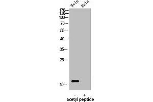Western Blot analysis of hela using Acetyl-Histone H3 (K9) Polyclonal Antibody. (HIST1H3A/HIST2H3A/H3F3A (acLys9) antibody)