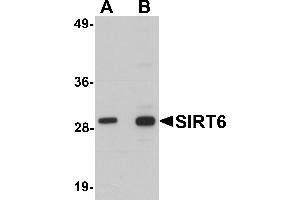 Western blot analysis of SIRT6 in HeLa cell lysate with SIRT6 antibody at (A) 0. (SIRT6 antibody  (C-Term))