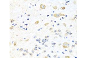 Immunohistochemistry (Paraffin-embedded Sections) (IHC (p)) image for anti-Inositol Polyphosphate-5-Phosphatase K (INPP5K) antibody (ABIN7011997)