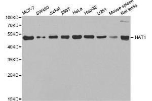 Western blot analysis of extracts of various cell lines, using HAT1 antibody.
