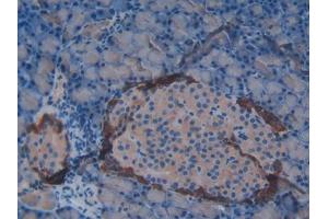 DAB staining on IHC-P; Samples: Rat Pancreas Tissue (Vip antibody  (AA 34-157))