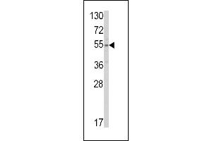 Western blot analysis of SLC38A3 Antibody (Center) (ABIN390795 and ABIN2841042) in HepG2 cell line lysates (35 μg/lane). (SLC38A3 antibody  (AA 442-468))