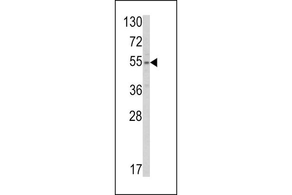 SLC38A3 anticorps  (AA 442-468)