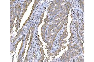 IHC analysis of SND1 using anti-SND1 antibody (ABIN7600526).