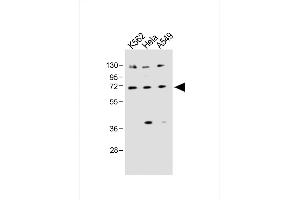 All lanes : Anti-SLC22A4 Antibody (C-term) at 1:1000 dilution Lane 1: K562 whole cell lysate Lane 2: Hela whole cell lysate Lane 3: A549 whole cell lysate Lysates/proteins at 20 μg per lane. (SLC22A4 antibody  (C-Term))