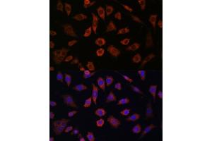 Immunofluorescence analysis of L929 cells using CYTH1 antibody (ABIN7266661) at dilution of 1:100. (Cytohesin 1 antibody  (AA 1-70))