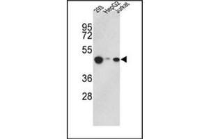 Image no. 1 for anti-Histone Acetyltransferase 1 (HAT1) (AA 390-419), (C-Term) antibody (ABIN356621) (HAT1 antibody  (C-Term))