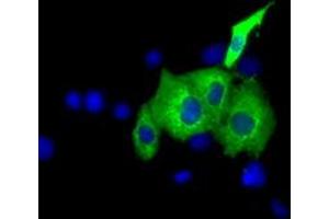 Image no. 1 for anti-Insulin-Like Growth Factor 2 mRNA Binding Protein 2 (IGF2BP2) antibody (ABIN1498822) (IGF2BP2 antibody)