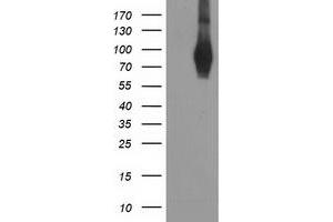 Western Blotting (WB) image for anti-phosphodiesterase 4B, cAMP-Specific (PDE4B) antibody (ABIN1500093)