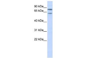 KCNQ1 antibody used at 1 ug/ml to detect target protein. (KCNQ1 antibody  (N-Term))