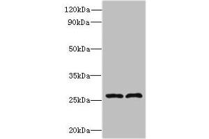 Western blot All lanes: FAM71C antibody at 6 μg/mL Lane 1: 293T whole cell lysate Lane 2: Jurkat whole cell lysate Secondary Goat polyclonal to rabbit IgG at 1/10000 dilution Predicted band size: 28 kDa Observed band size: 28 kDa (FAM71C antibody  (AA 1-241))